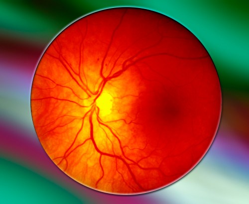 Photo of the retina at the back of the eyeball